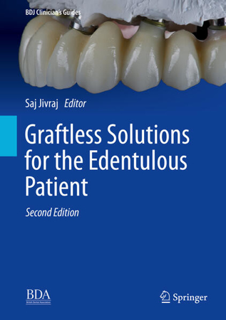 Bild zu Graftless Solutions for the Edentulous Patient von Jivraj, Saj (Hrsg.)