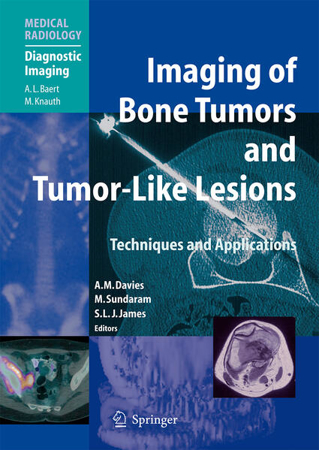 Bild zu Imaging of Bone Tumors and Tumor-Like Lesions (eBook) von Davies, A. Mark (Hrsg.) 